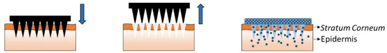 Fig.1. The solid microneedles.