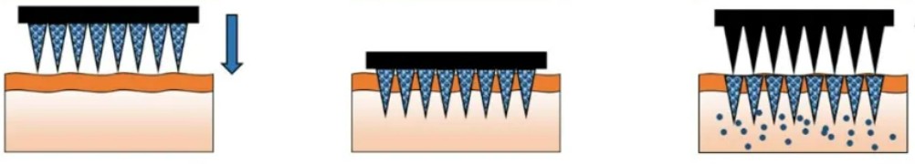 Fig.1. The solid microneedles.