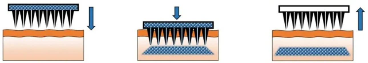 Fig.1. The hollow microneedles.