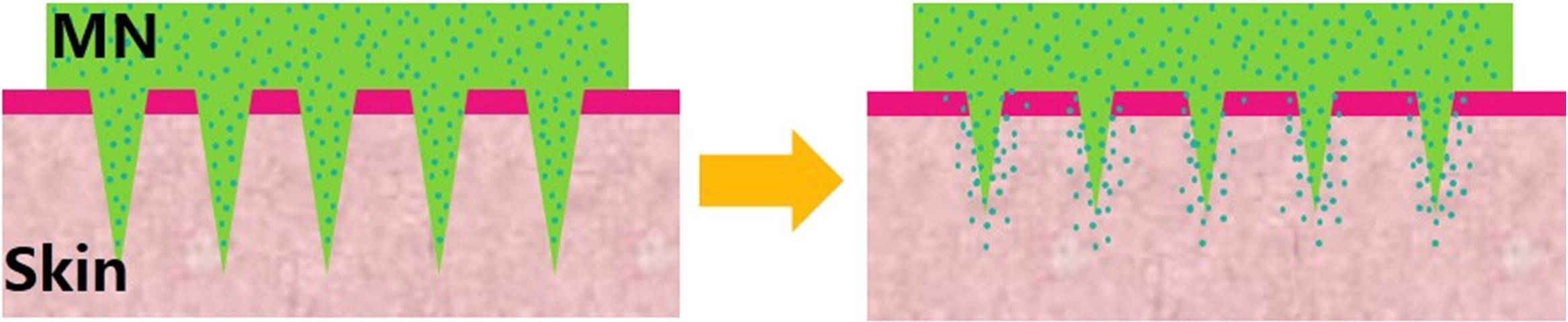 Fig.1. Principle of dissolving microneedles.