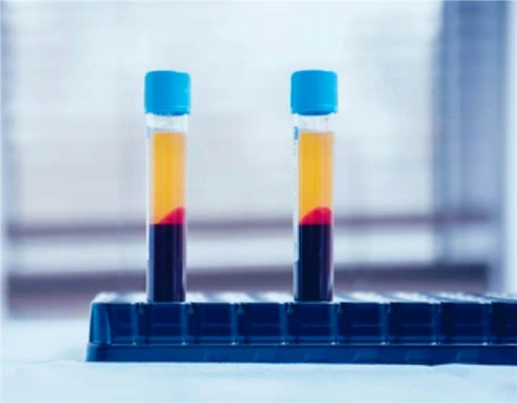 Plasma Sample