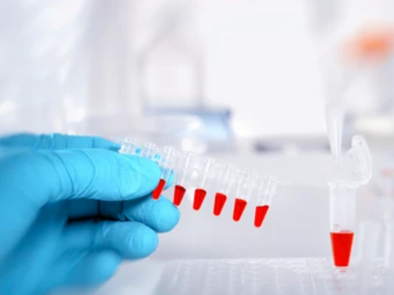 Biomarker Assay Services