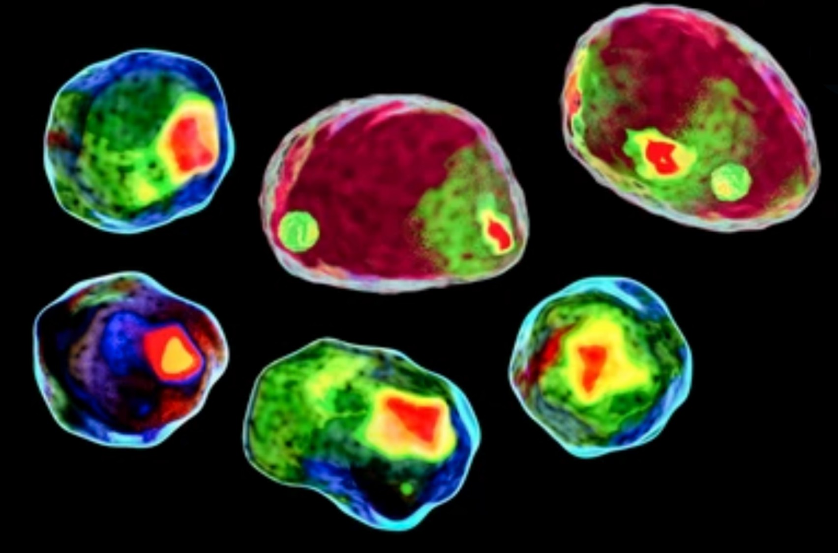 Human cell colored in a new diagnostic technique.