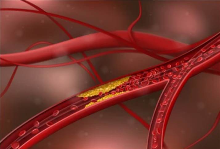Cardiovascular Disease Pharmacodynamic Research