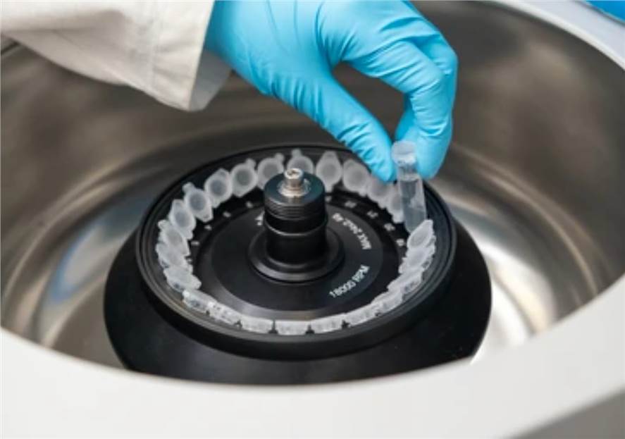 GC-MS Untargeted Metabolomics Service