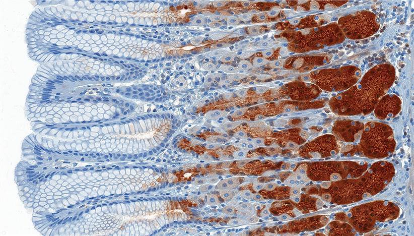 Immunohistochemical Technology Platform
