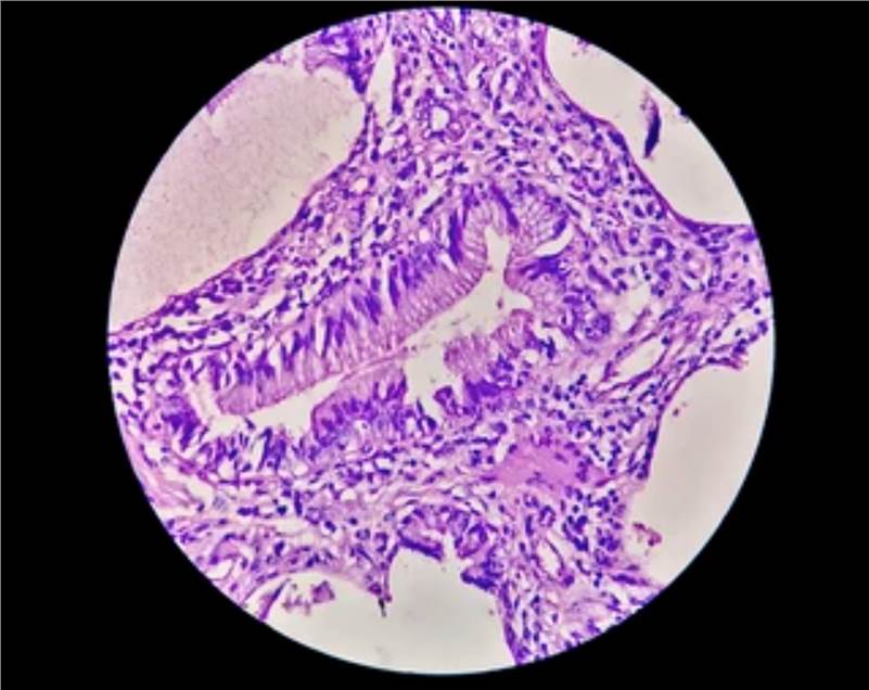 In vivo Mammalian Erythrocyte Micronucleus Test