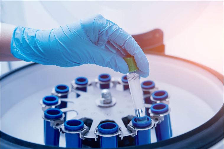 Metabolomics Services