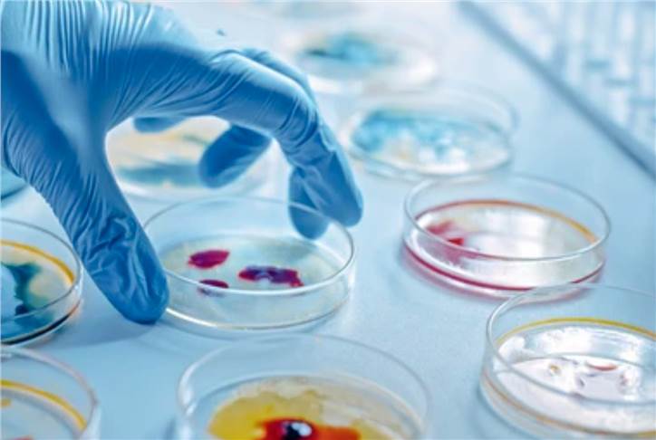 Microbial Targeted Metabolomics Analysis