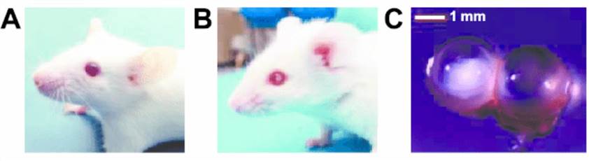 Cataract development in Ptch1 b/- mice after irradiation at postnatal day 2.