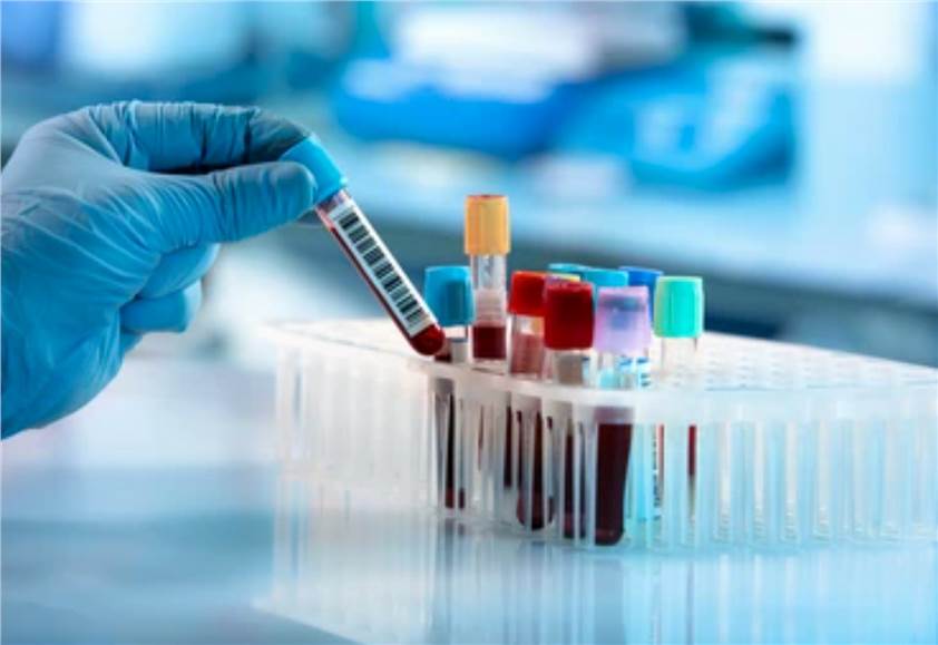 In Vivo Pharmacokinetics Evaluation