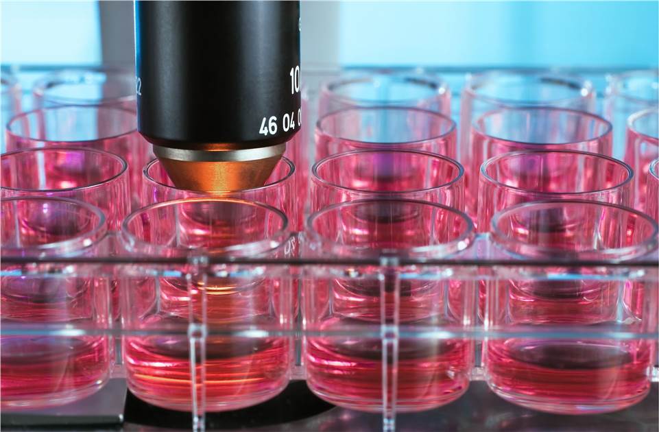 Cytokine Assay Service