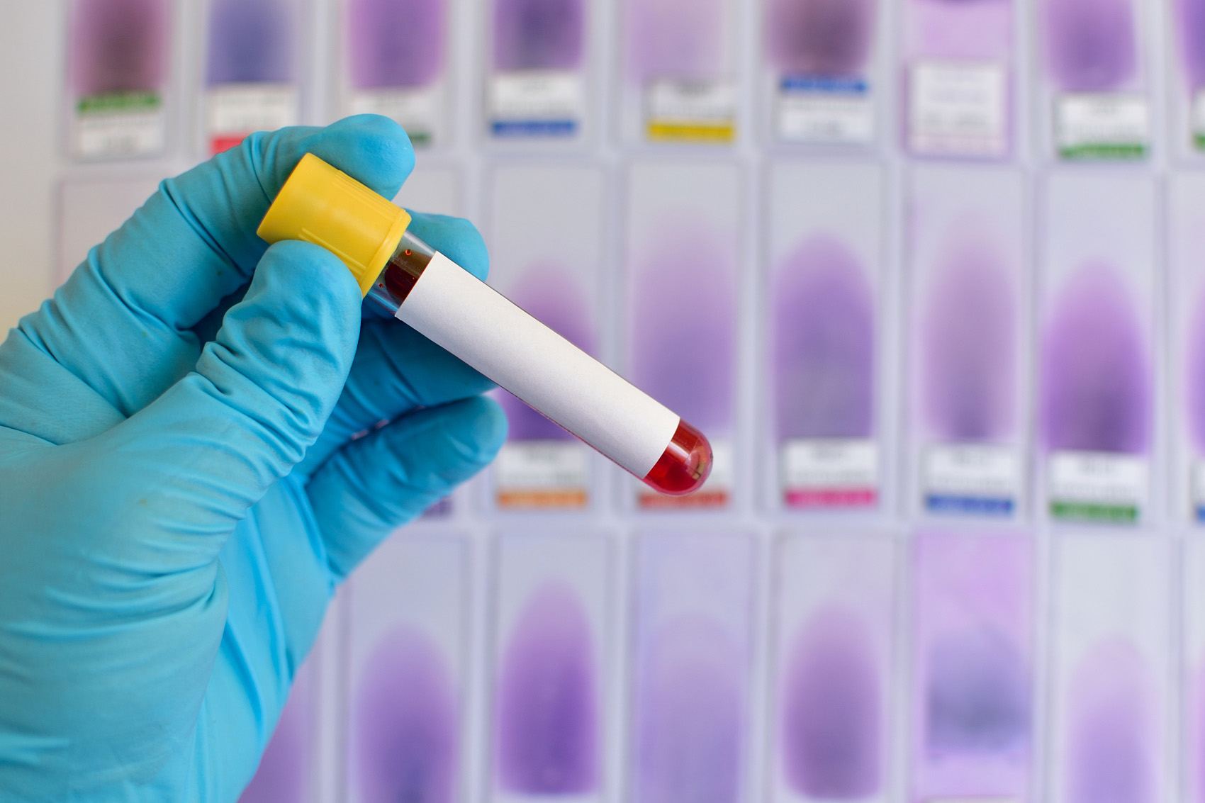 Extensive Drug Safety Evaluation Solutions